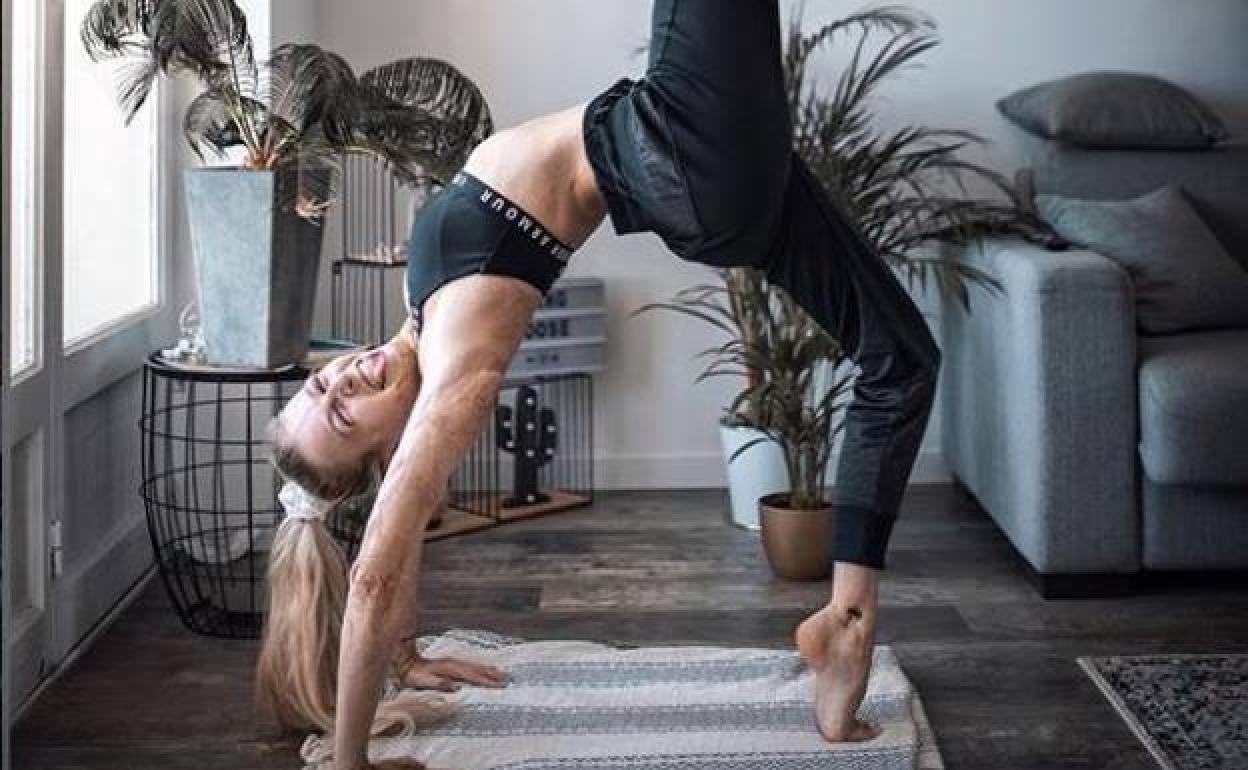 Un cigarrillo quemó el disfraz de algodón de Bourges, que pasó tres meses en un coma inducido. 