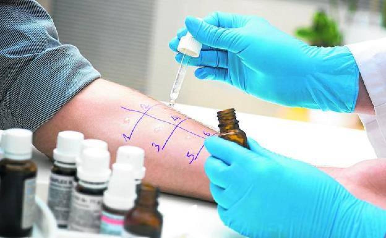rueba cutánea para detectar alergias. Consiste en introducir en la piel una cantidad ínfima del posible alérgeno. 