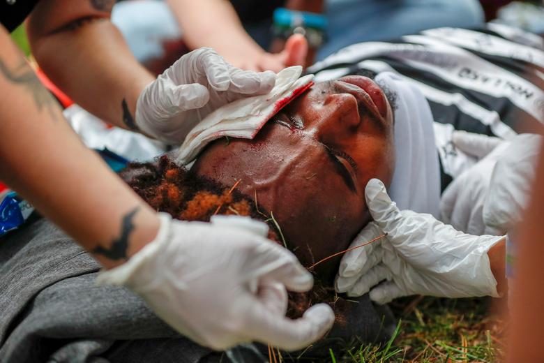 Un hombre resulta herido después de ser golpeado en la cabeza por un objeto en una protesta cerca del tercer recinto de la policía de Minneapolis después de que un oficial de policía blanco fuera captado en el video de un transeúnte presionando su rodilla en el cuello del hombre afroamericano George Floyd, quien luego murió. en un hospital, en Minneapolis.