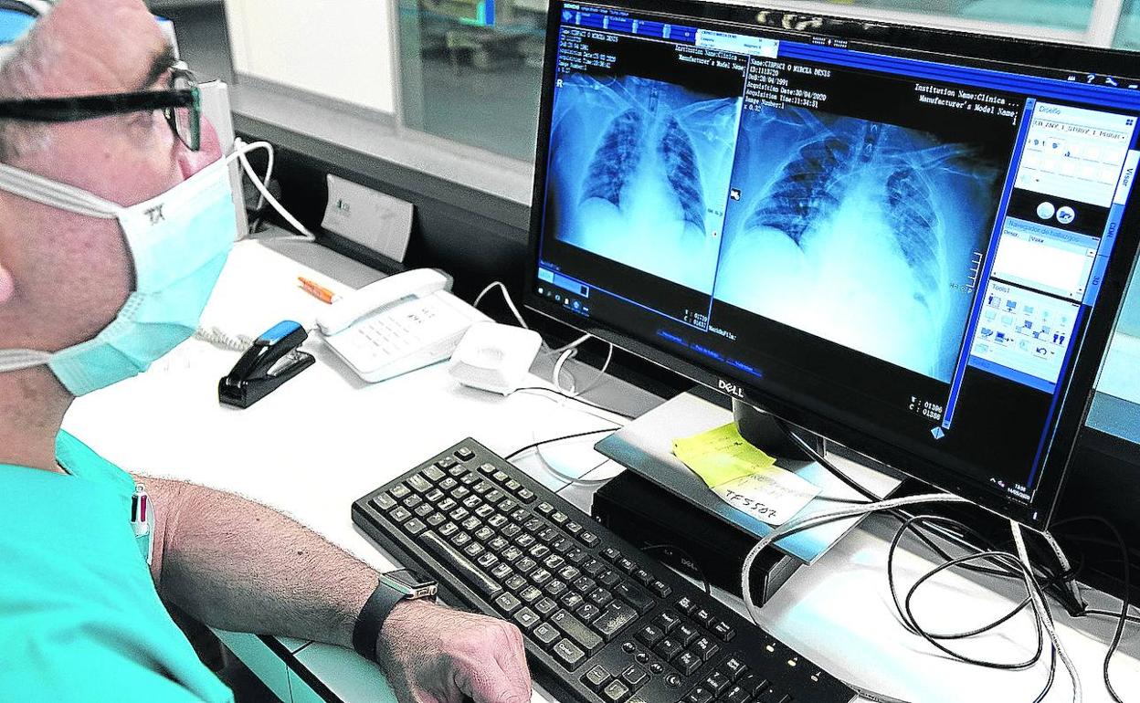 Un especialista analiza las radiografías de unos pulmones. 