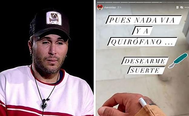 Kiko Rivera ha pasado por el quirófano.