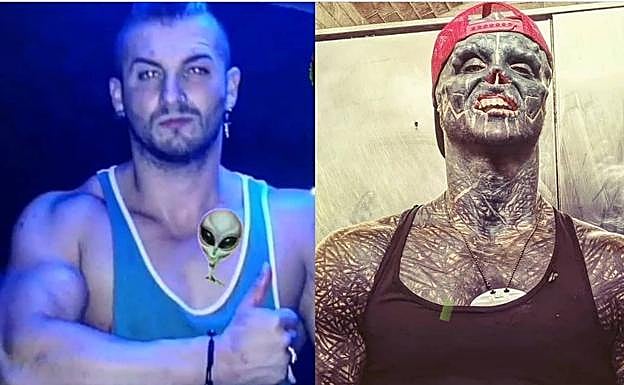 Imagen principal - El joven francés que quiere parecer un alien se opera en Bizkaia