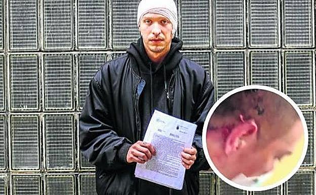 Agresión. Kevin Rubio con la denuncia; abajo, las heridas en la cabeza.