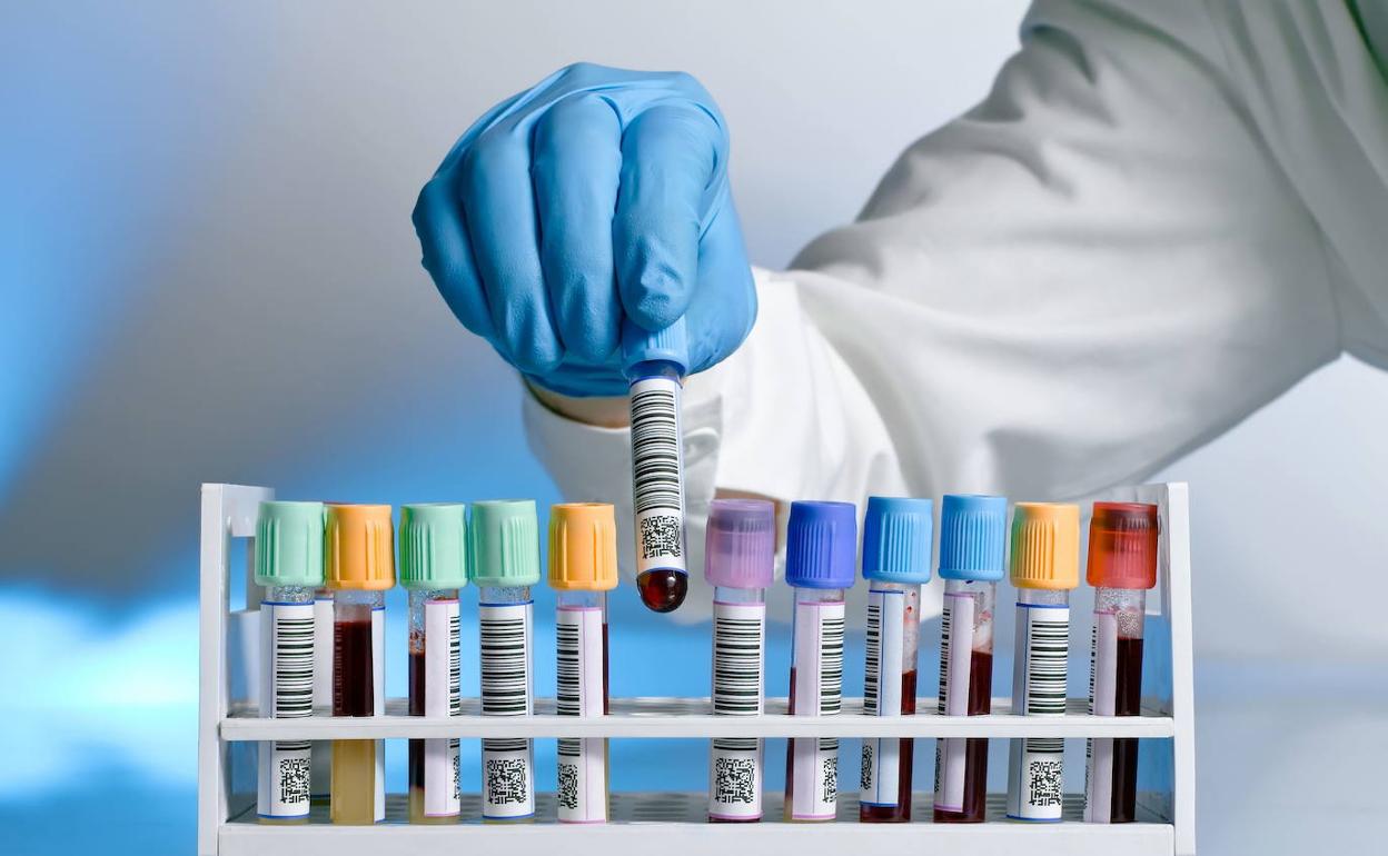 Botswana, hiesaren aurkako 95-95-95 erronka lortzen duen nazioarteko hirugarren herria