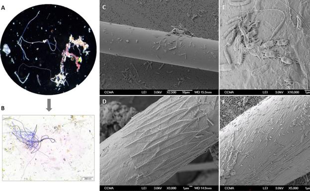 Imagen de las fibras analizadas al microscopio y las bacterias halladas en ellas aportados por el estudio.