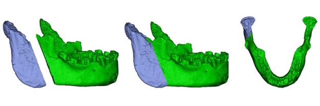 Reconstrucción del modelo 3D de la mandíbula de Banyoles. 