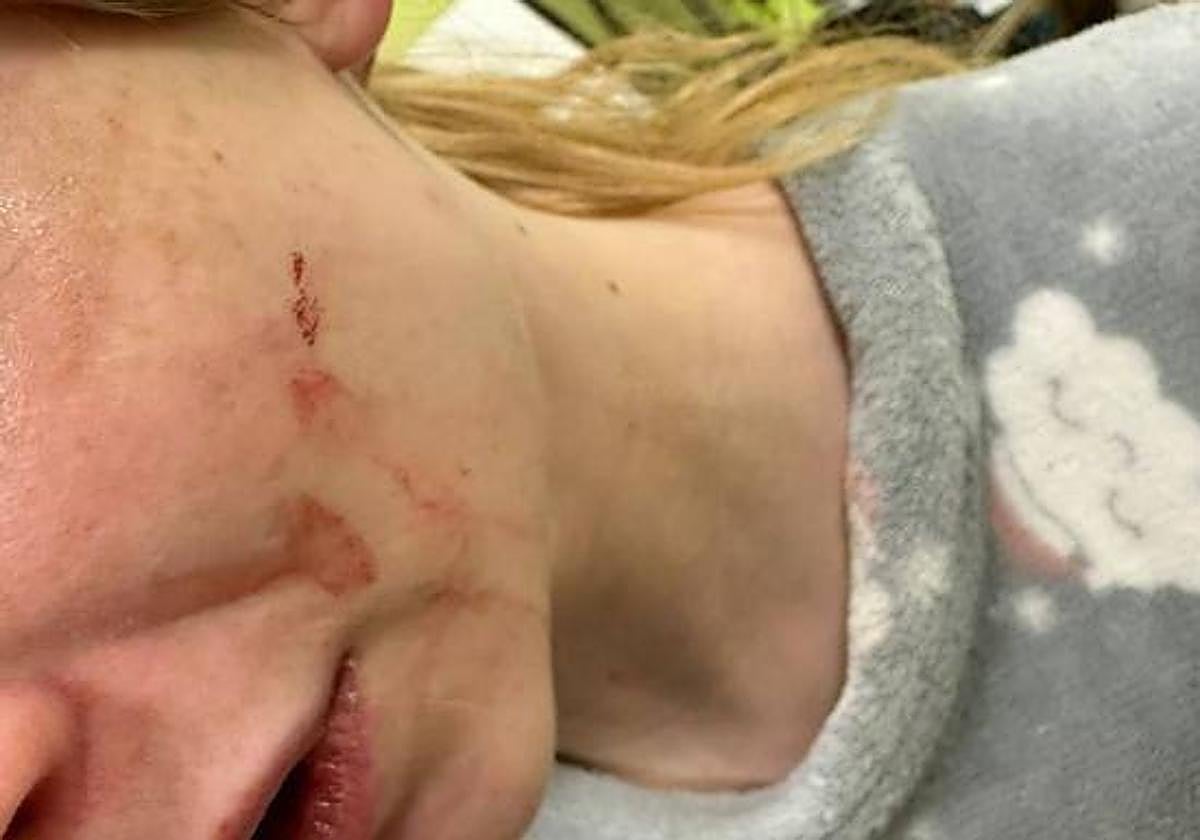 La joven agredida, en el centro de salud.