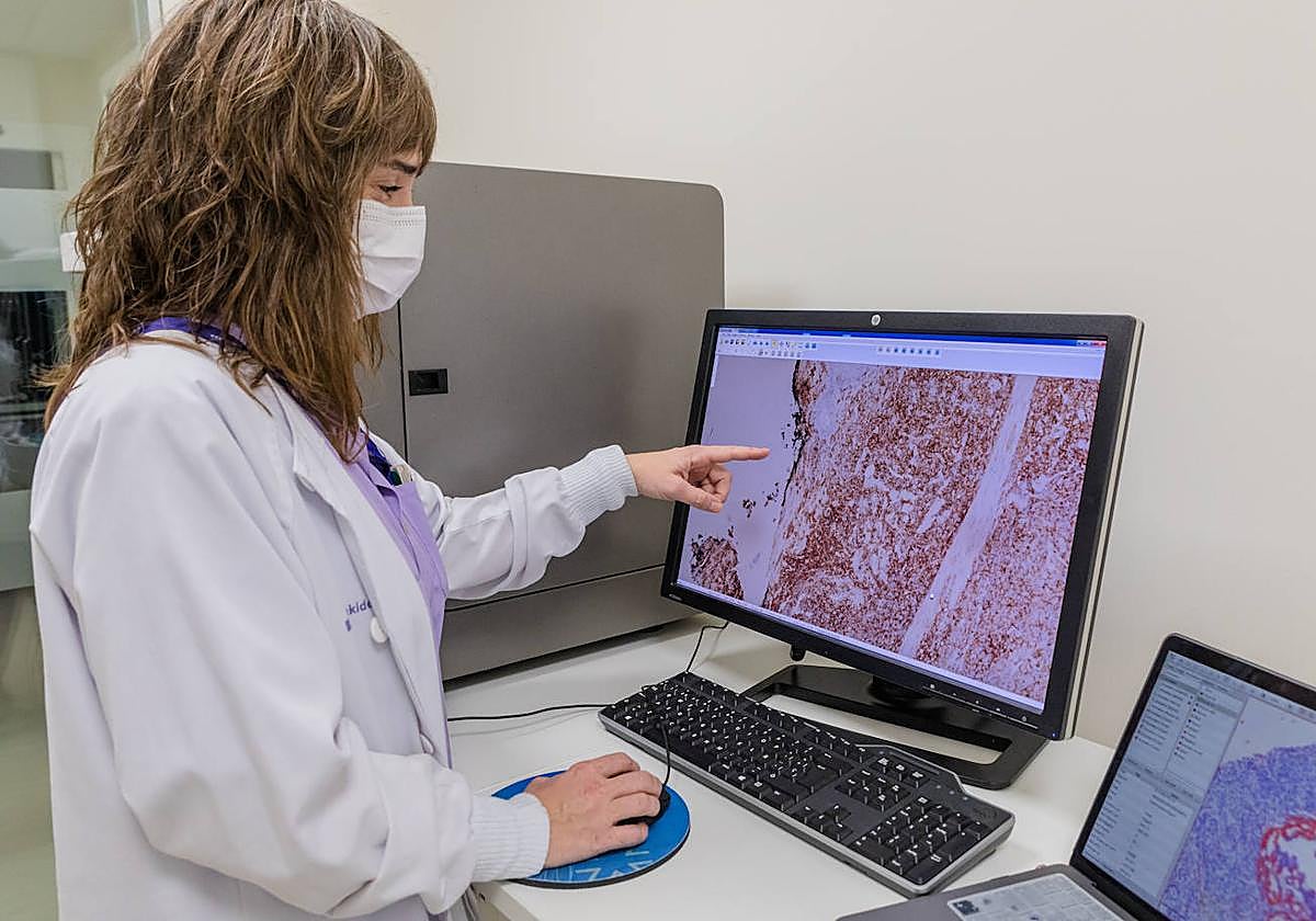 Bioaraba lidera también una investigación para prevenir recaídas del cáncer de colon.