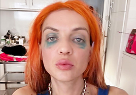 Camilín cumple un mes hormonándose: este es su nuevo rostro