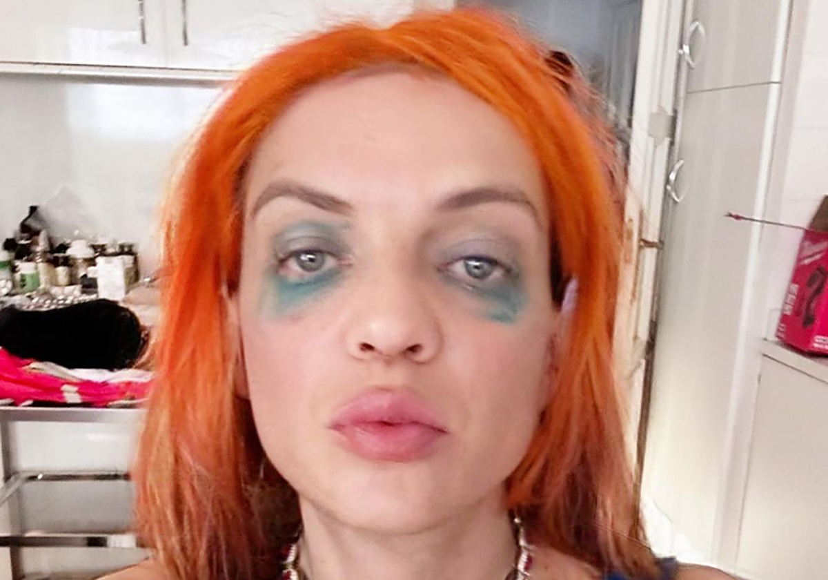 Camilín cumple un mes hormonándose: este es su nuevo rostro