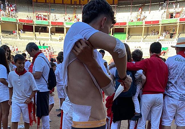 El joven bilbaíno muestra las heridas tras ser golpeado por el toro.