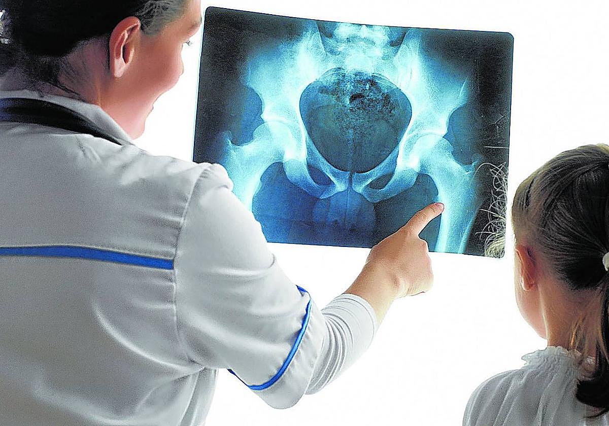 Las consultas de Traumatología son las que acumulan la lista de espera más voluminosa en Euskadi con 13.882 personas.