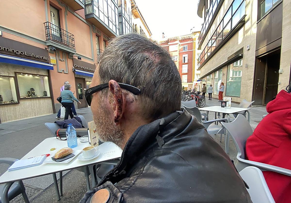 Iñaki, uno de los dos 'sin techo' atacados en Vitoria y fallecido por otras causas.