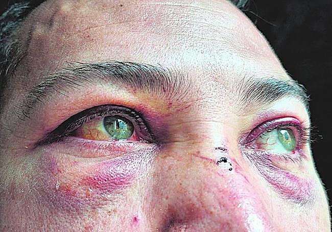 La víctima muestra las secuelas de la agresión.