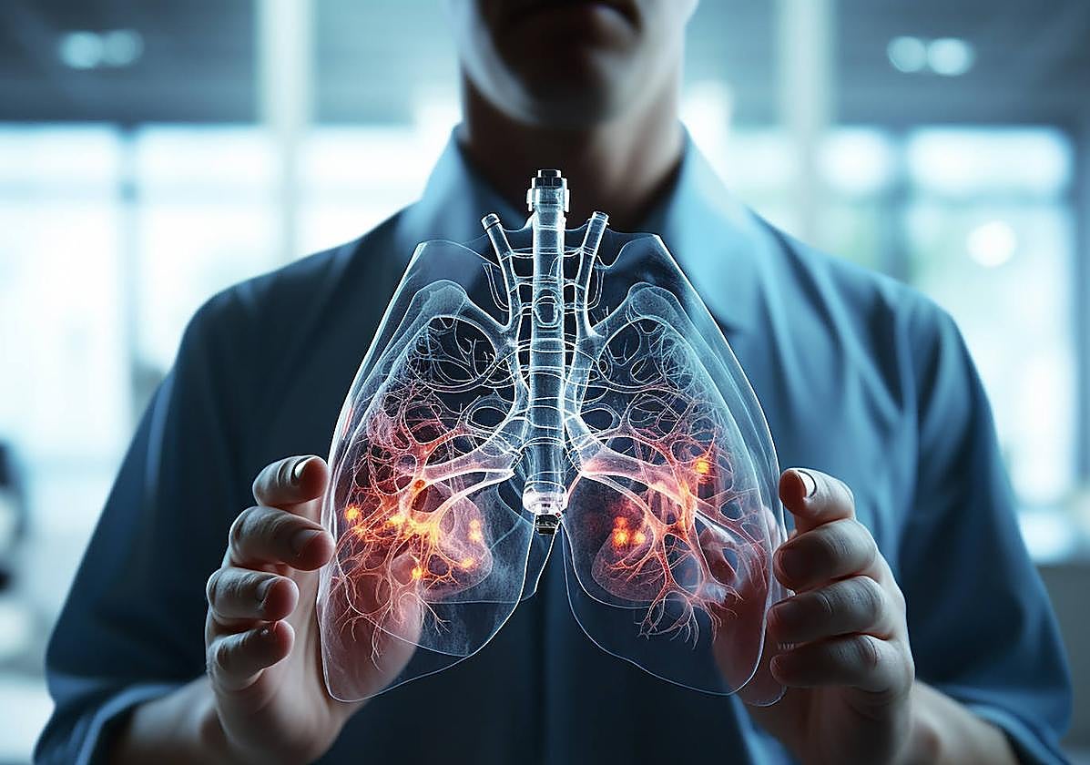 Un especialista muestra el aspecto de unos pulmones dañados por la tuberculosis.