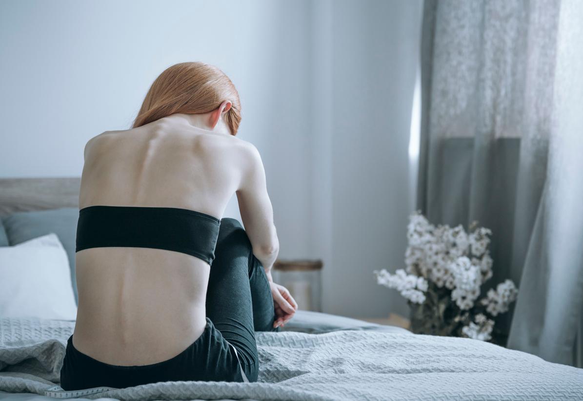 Los casos de anorexia han aumentado tras el confinamiento