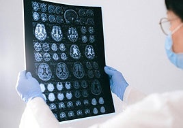 Este es el popular alimento que ayuda a combatir la pérdida de memoria en la vejez, según la ciencia