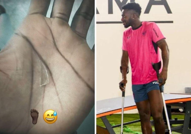 Este es el cristal que Iñaki Williams tenía en el pie y con el que jugó durante dos años