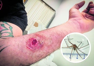 La venenosa araña violinista ataca en Bizkaia