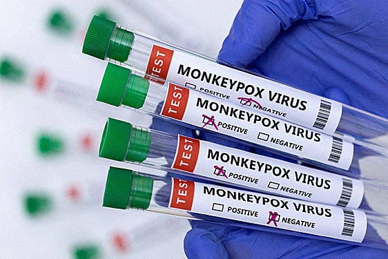España lidera los contagios de la viruela del mono en la UE, mientras la OMS estudia declarar una emergencia