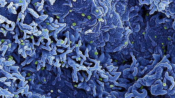 ¿Por qué la viruela del mono ahora se llama mpox?