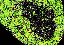 Imagen en superresolución de una célula cancerígena.