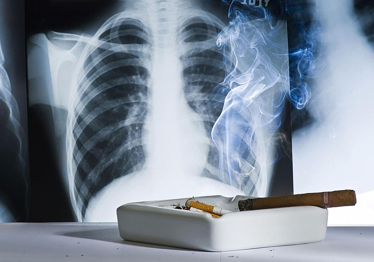 El 80% de los casos de cáncer de pulmón podría evitarse, porque están directamente provocados por el consumo, activo o pasivo, del tabaco.