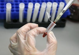 Confirman que un análisis de sangre puede detectar precozmente el Alzheimer