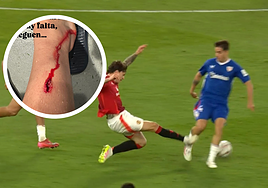 Prados muestra la herida sangrante por la dura entrada de Lindelof: «No hay falta, jueguen...»