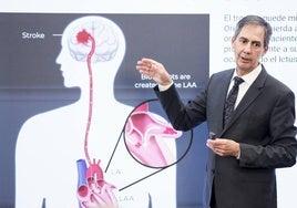 «Hablamos del sueño de curar la fibrilación auricular y de olvidar los anticoagulantes»