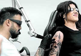 Adiós a la tinta. Andrea Palacios, en una de las sesiones para borrarse un tatuaje.