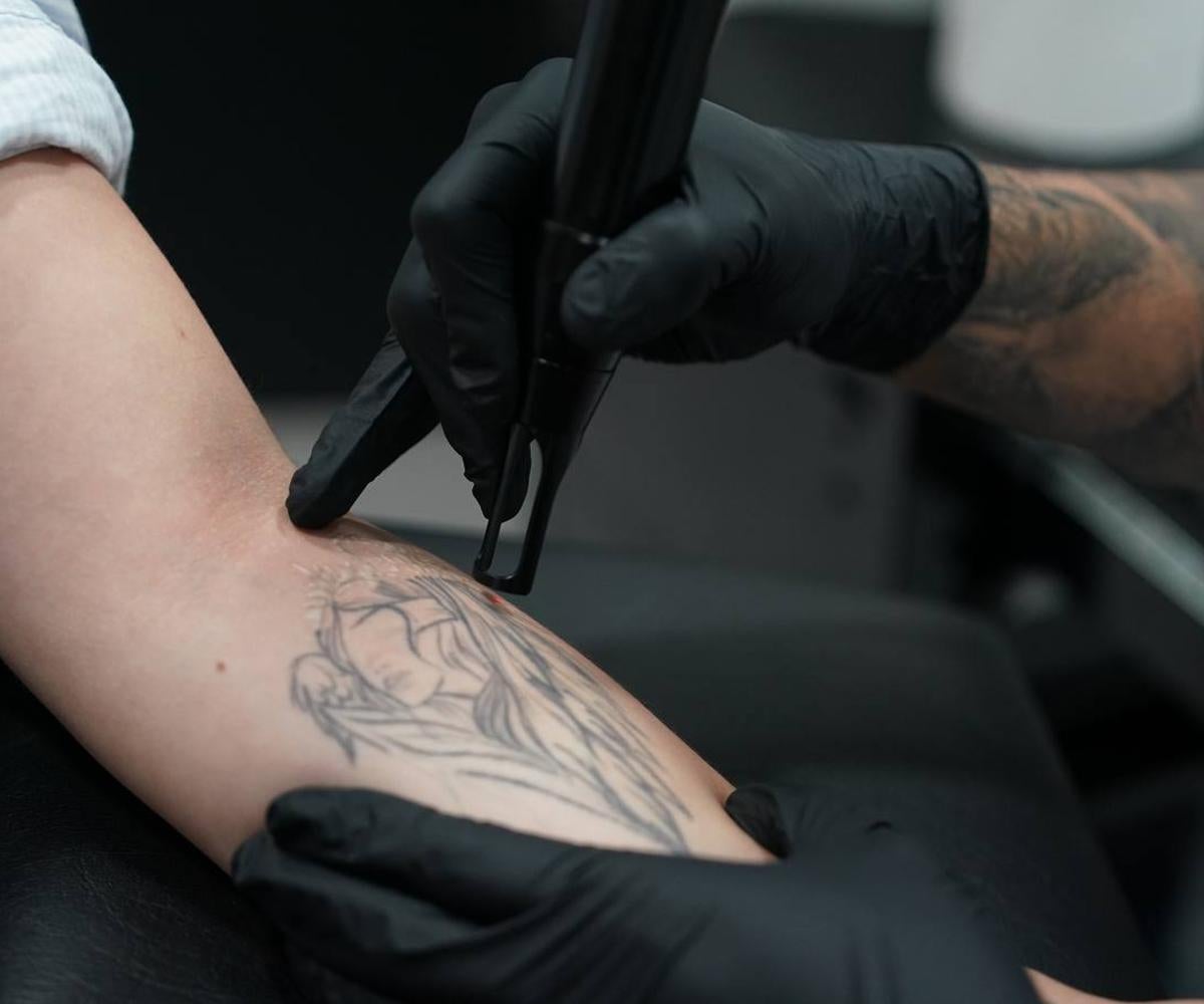 Se quitan con una máquina láser y el dolor «es similar al que sientes cuando te haces un tatuaje»