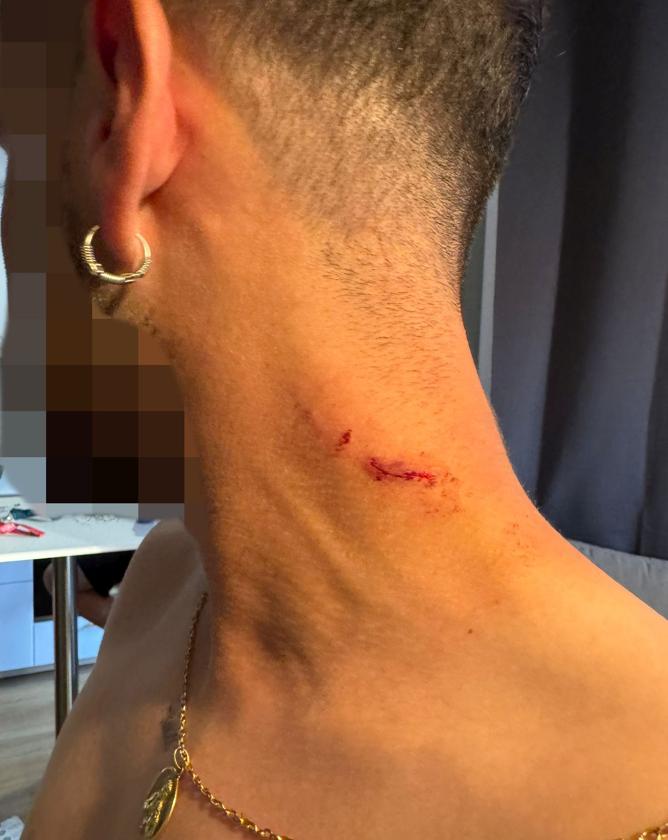 Un joven vizcaíno denuncia una agresión policial en un piso en Francia