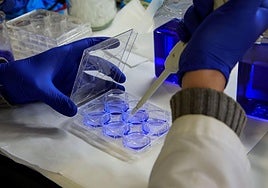 ¿Por qué por primera vez mueren más mujeres de cáncer de pulmón que de mama?