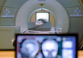 Muere un hombre tras ser succionado por una máquina de resonancias en EEUU