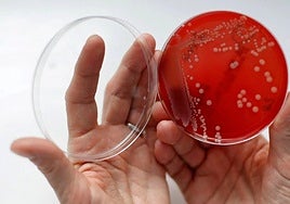 Las superbacterias causan 24.000 muertes al año en España.