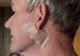 El chef anuncia en sus redes la operación para eliminar el cáncer de piel