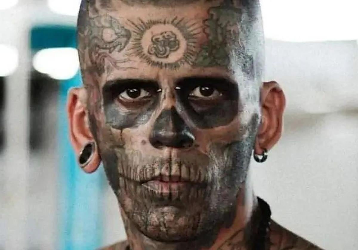 Leandro de Souza, antes de sus tratamientos