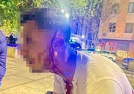 El corte en la cara que presentaba el agredido con una botella.