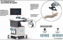 Un robot quirúrgico de columna 'made in' Gipuzkoa