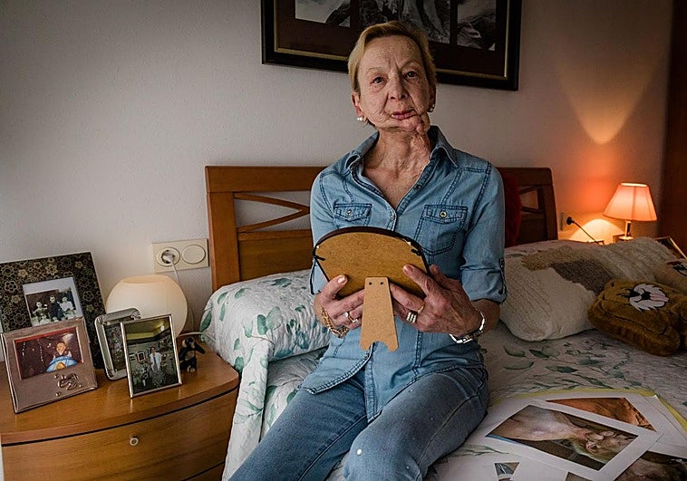 El calvario de una vitoriana tras seis operaciones en Osakidetza: «Me han destrozado la mandíbula y la vida»