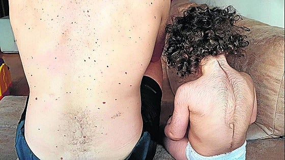 El fiscal pide la absolución para los acusados por el caso del crecepelo suministrado a niños