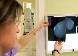El cáncer de mama afecta de media a 16.500 mujeres por año en España