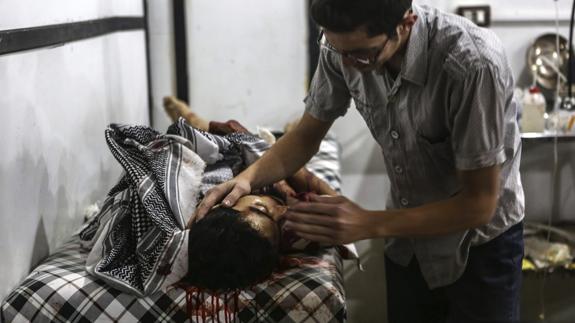 Un hombre recibe tratamiento médico tras ser herido en un bombardeo en Siria.