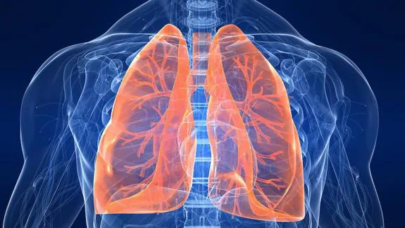 La mayor parte de los casos de sarcoidosis van acompañados de síntomas respiratorios. 