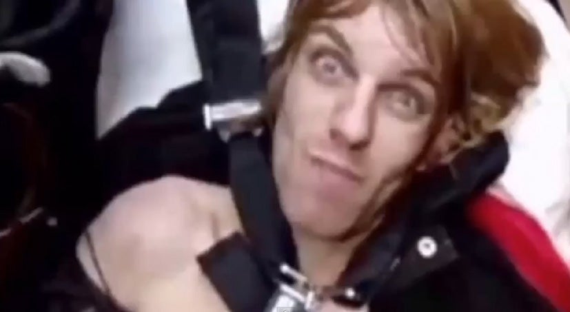 Imagen de uno de los afectados por la sustancia. 