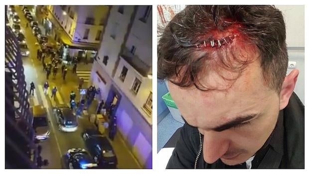 Imagen de la brutal pelea y la herida de uno de los agentes.