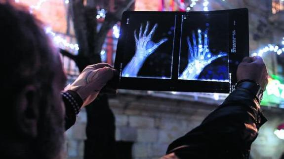 Txema, uno de los dos vigilantes agredidos, observa una radiografía de su mano. 