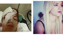 Nicole, antes y después de la agresión. / Sur