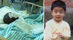 El niño lucha por la vida en el hospital. / Daily Mail